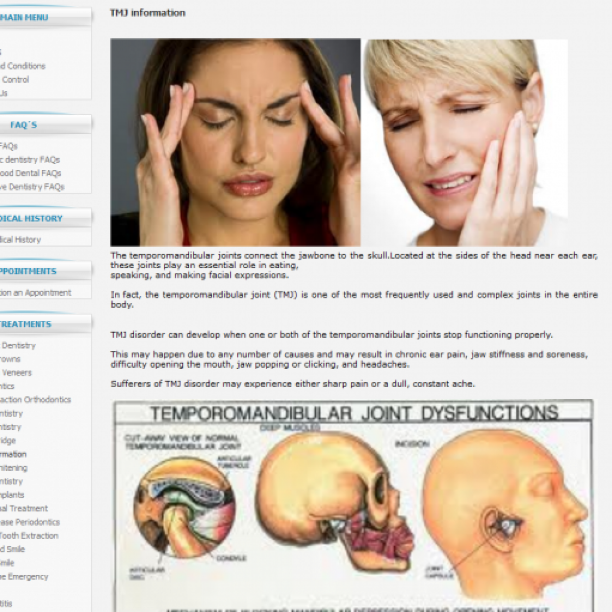 TMJ Information
