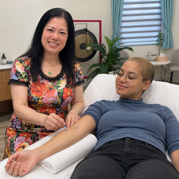 Acupuncture